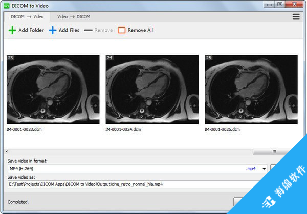 DICOM to Video(DICOM转视频工具)_1