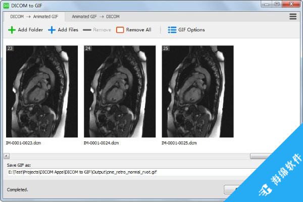 DICOM to GIF(DICOM文件转GIF工具)_1