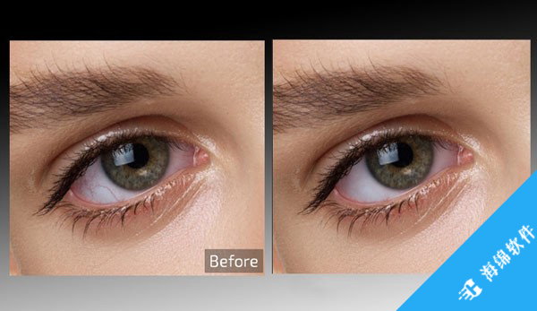 Retouch4me Eye Vessels(图片处理工具)_1